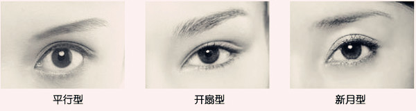 武汉割双眼皮选哪种形状好看