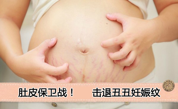 治疗妊娠纹要注意什么
