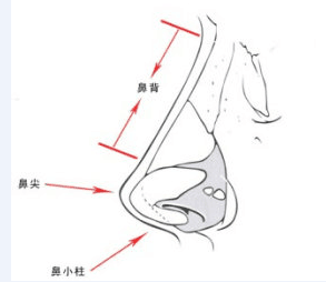 武汉需要做隆鼻修复有哪些情况
