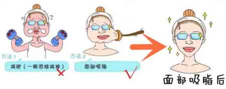 武汉面部吸脂后应该怎样护理?