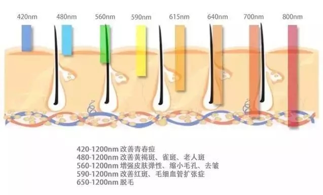 武汉光子嫩肤价格大概多少