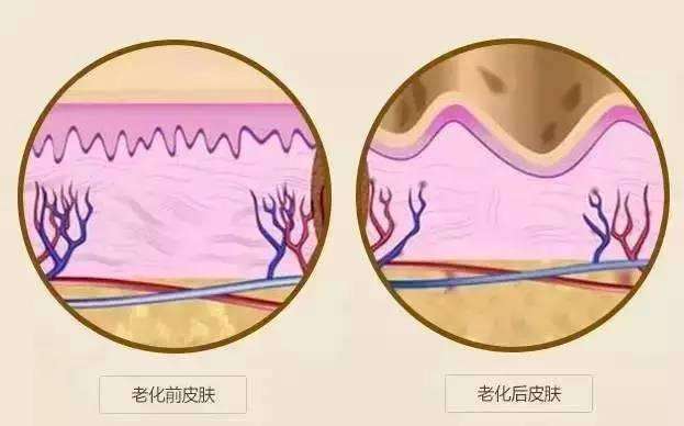 武汉激光除皱后怎么保养