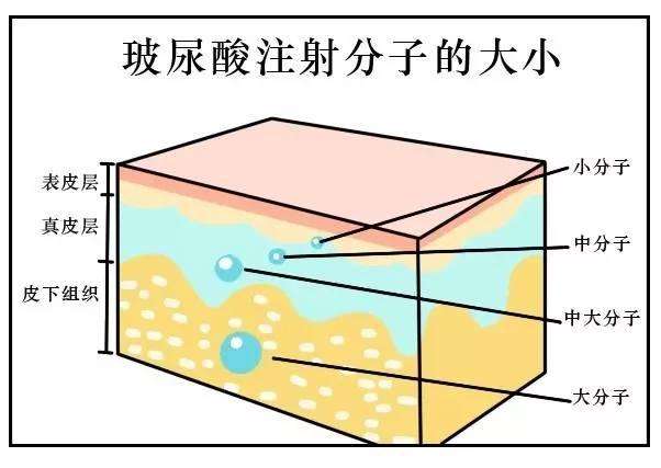 武汉玻尿酸到底有什么用